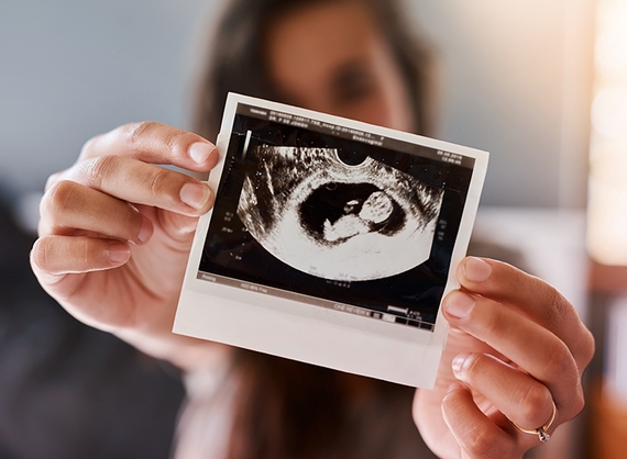 Ultrasound scan shown by woman of her child